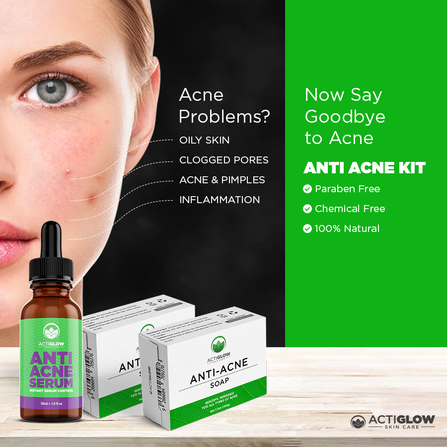 Say goodbye to acne